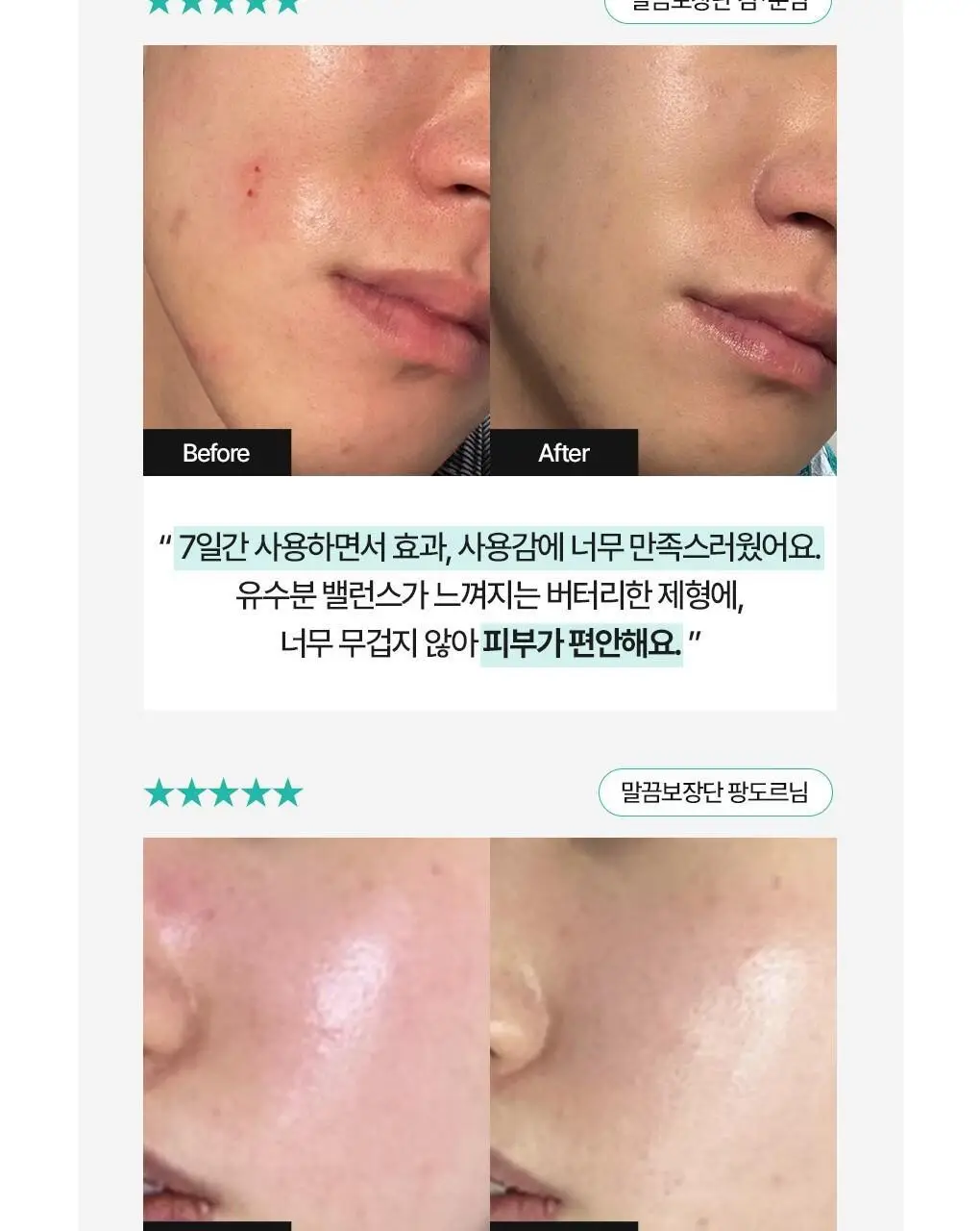 [가정의달특가] 브링그린 징크테카 리페어 흔적 크림 80ml (콜라보/기획) 상세페이지 10
